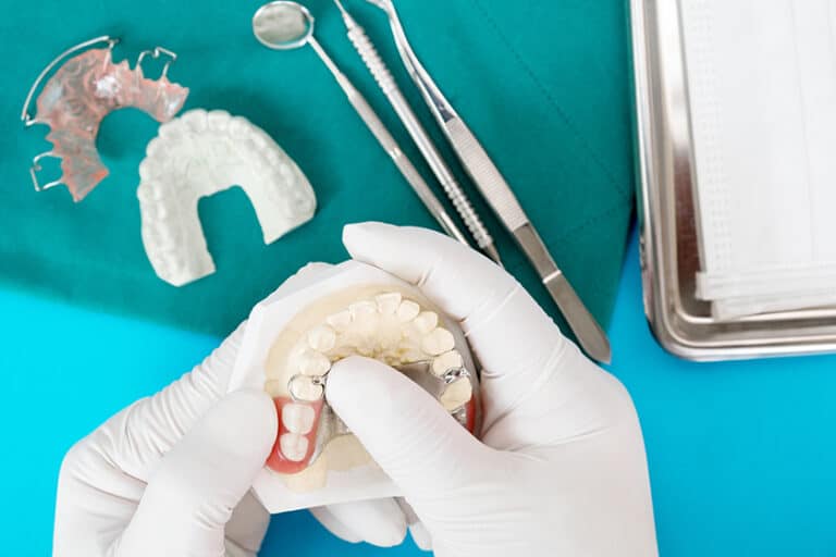 Classification and Elements of Removable Partial Dentures - Owens