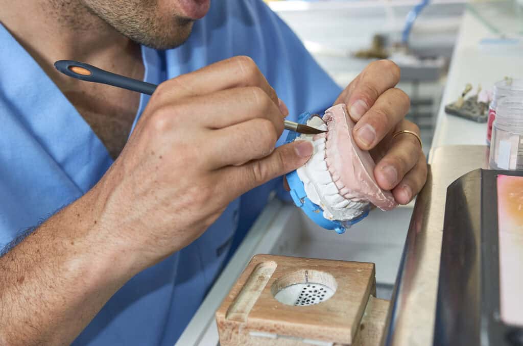 Get Dental Veneers