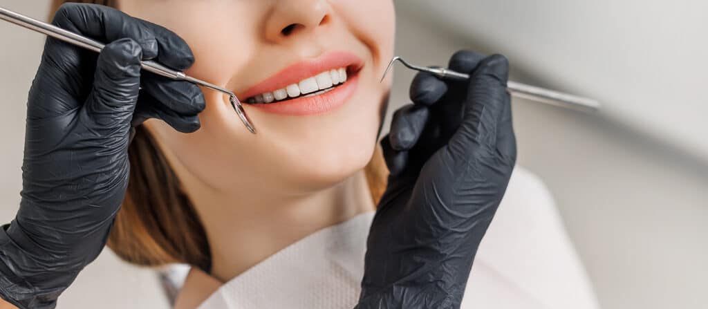 Smile with Dental Veneers