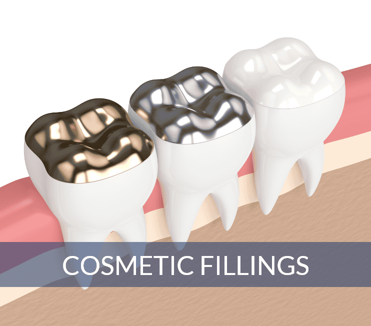 Cosmetic Fillings