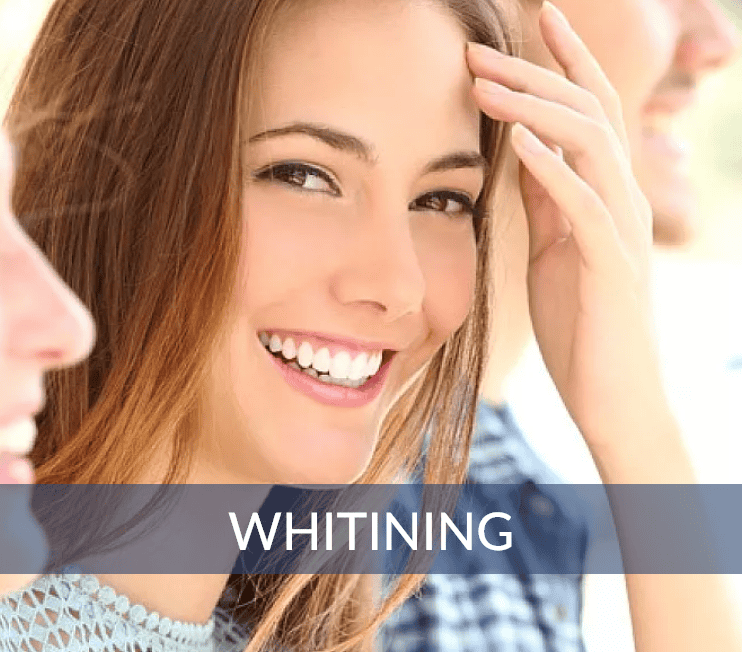Whitening Services